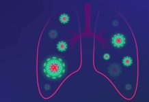 311 cazuri noi înregistrate în 24 de ore în Bihor